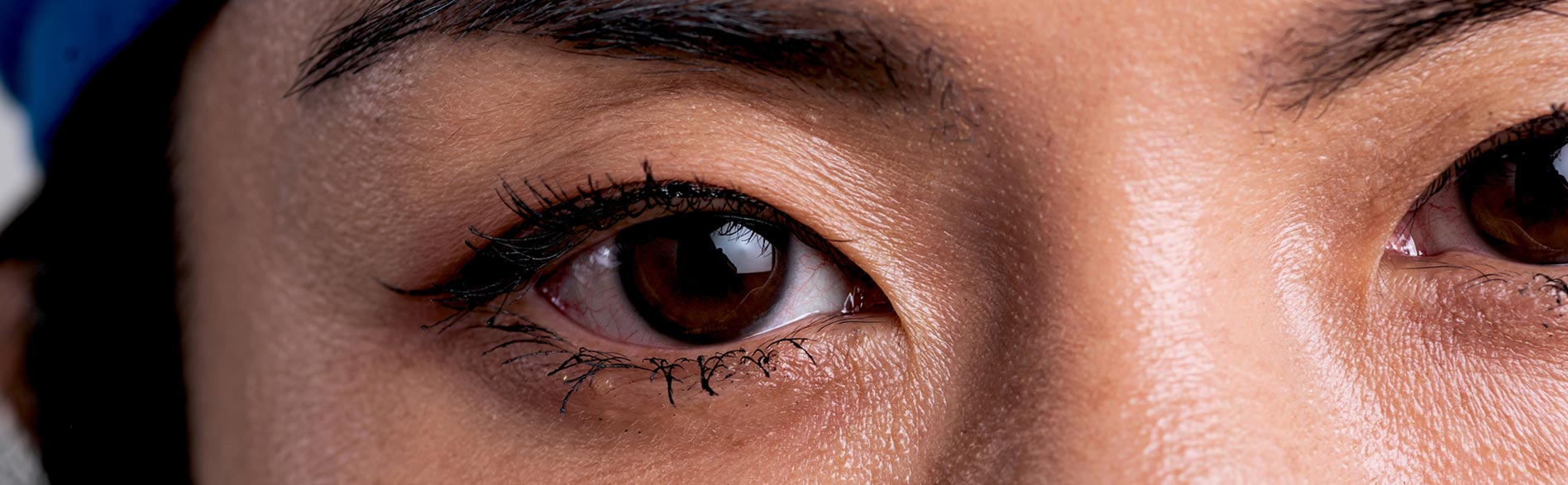 Close up of clinicians face wearing mask looking at camera