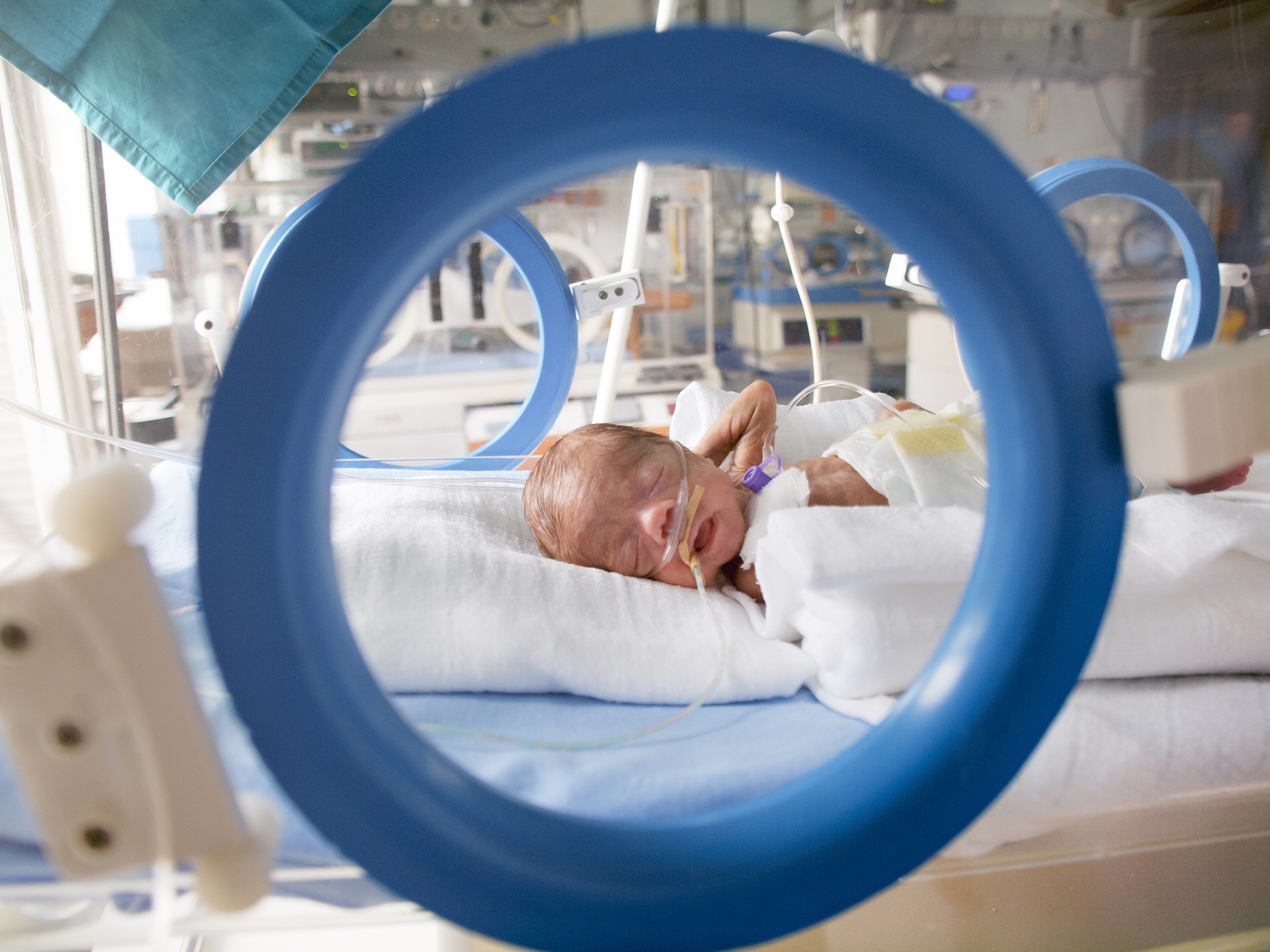 A neonatal patient lies in a crib in NICU