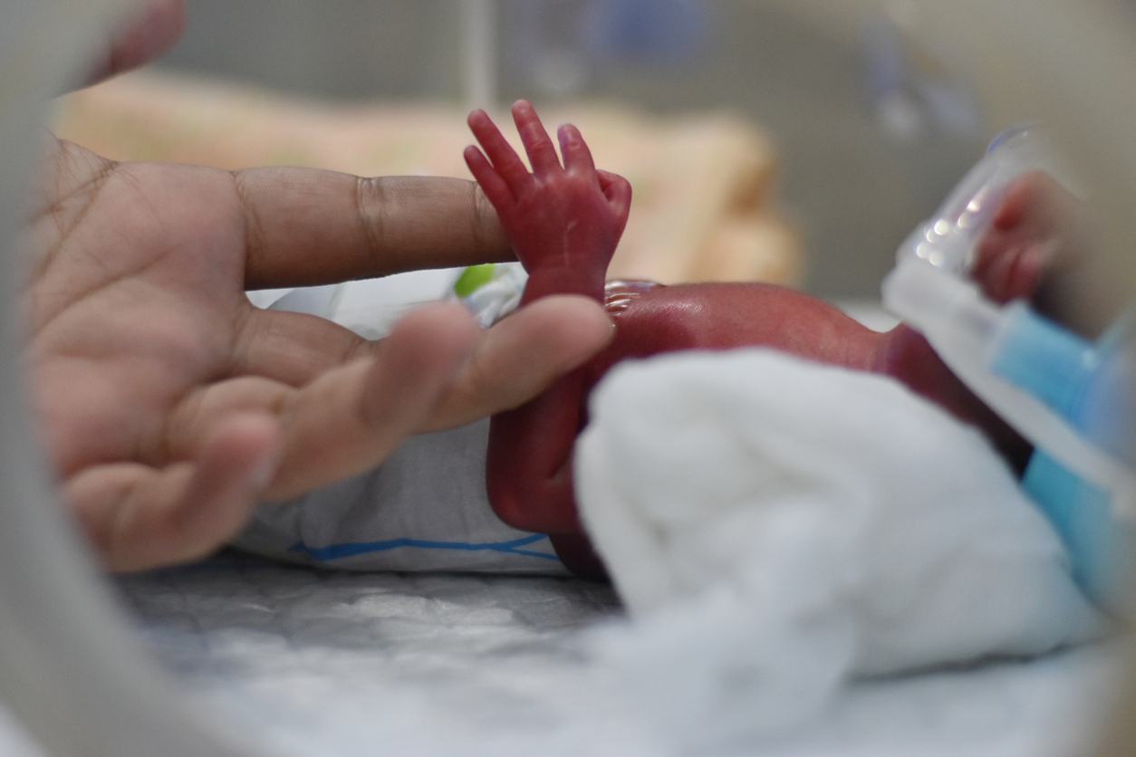 An adult hand gently touches the hand of a pre-term baby on a ventilator in the NICU