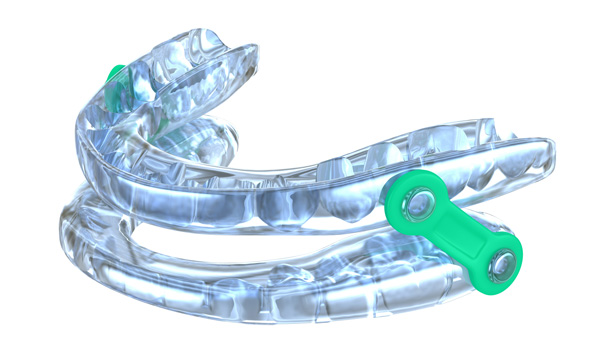 Mouthgard style oral appliance for treating sleep apnoes